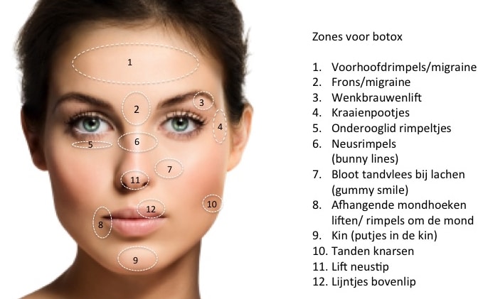 prijzen botox en fillers