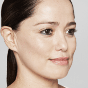 Restylane skinbooster voor blush