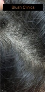 man voller haar na